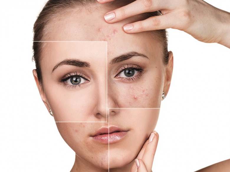 Skin Diseases in Bhosari | Skin Diseases Treatment - Dr. Jyoti's Homoeopathy Clinic.