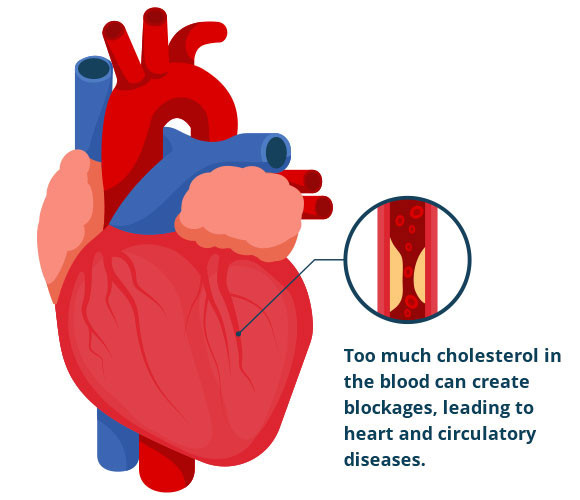 Dyslipidemia Treatment - Treatment Of Dyslipidemia