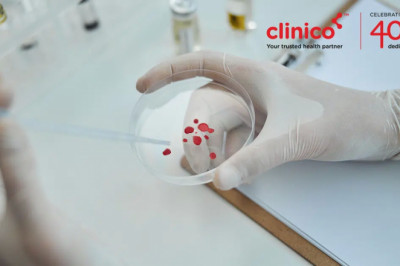 What is Blood Culture Test and when to take it?