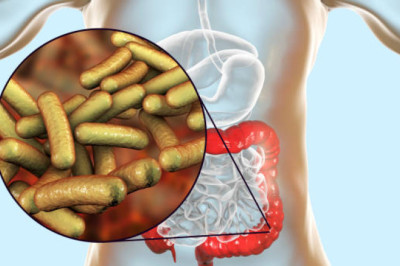 Treating Infections