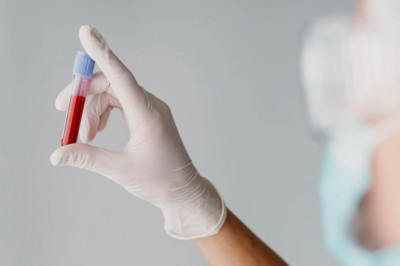 Why is Blood Culture Test So Important?