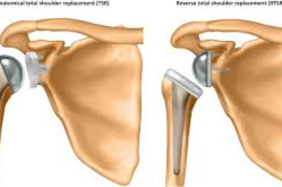 Opportunities and Innovations in the Oral Solid Dosage Pharmaceutical Formulation Market