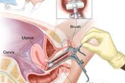 Cervical Cancer Screening Market Outlook: Innovations in Diagnostic Technologies Driving Expansion